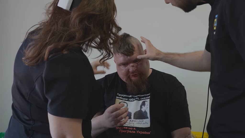 Surgeons restore faces — and hope — in war-torn Ukraine